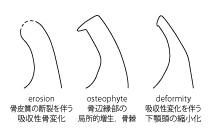 とっておきし新春福袋 [A11151818]第2版 冠橋義歯補綴学テキスト 歯科 ...